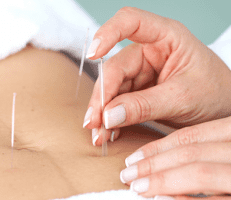 acupuncture needle being applied